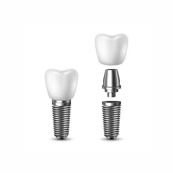 Single Tooth Dental Implant